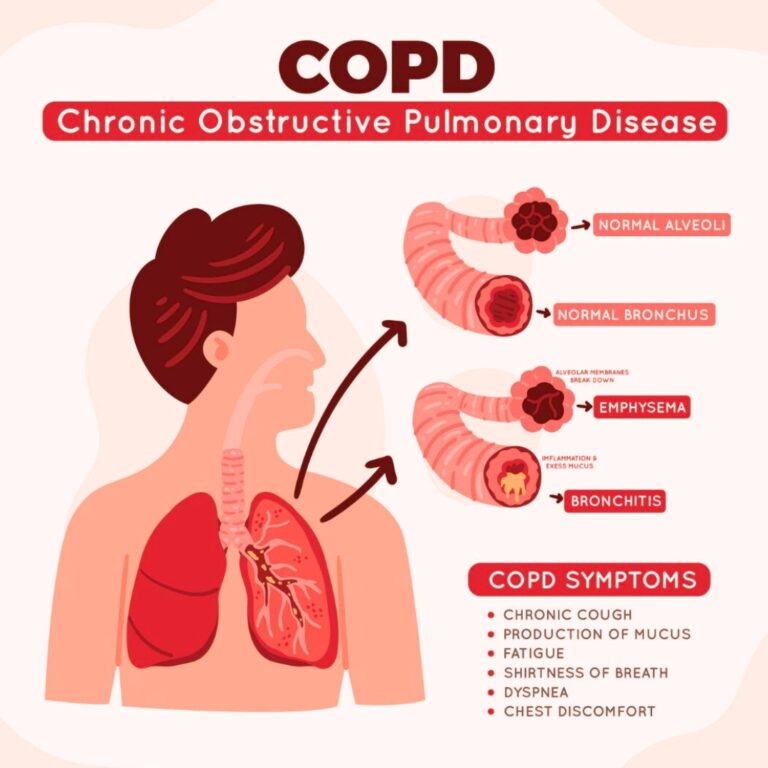 copd